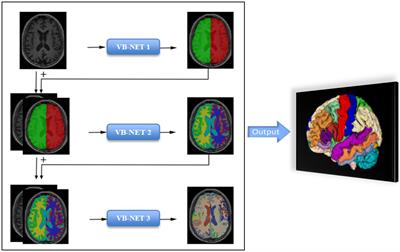 Automatic diagnosis of Parkinson’s disease using artificial intelligence base on routine T1-weighted MRI